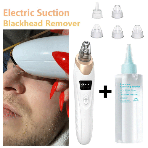 🫧Electric Pore Vacuum & Blackhead Remover – Rechargeable Spot Extractor Tool Set
