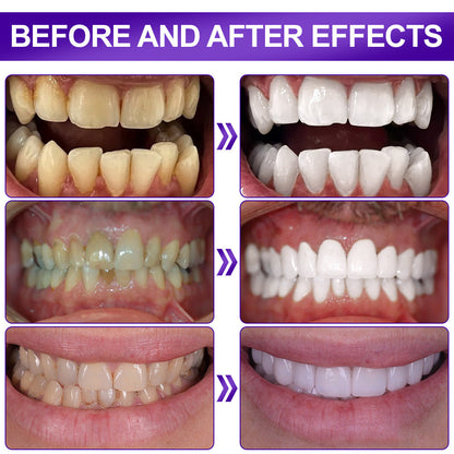 𝐅𝐥𝐲𝐬𝐦𝐮𝐬®🦷🦷𝐕𝟑𝟒 𝐖𝐇𝐈𝐓𝐄𝐍𝐈𝐍𝐆 𝐒𝐓𝐑𝐈𝐏𝐒 — Clinically proven to gently remove stains, whiten teeth, and restore natural brightness in just 30 minutes — safe for sensitive teeth and gums.